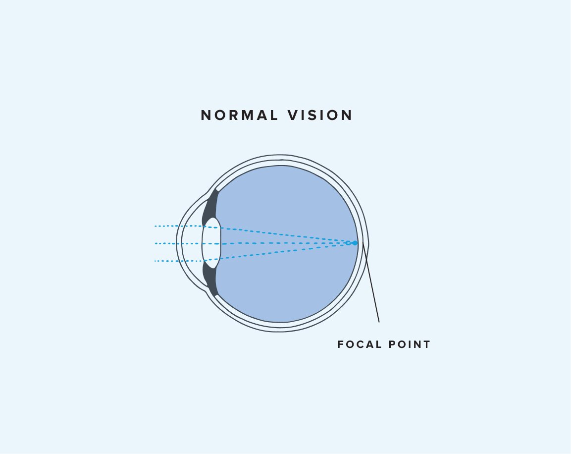 Normal Vision Eye Diagram 