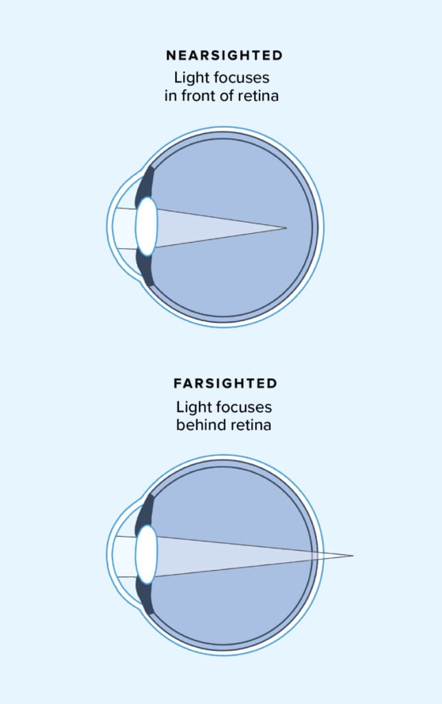 Nearsighted Vs Farsighted Key Differences Warby Parker