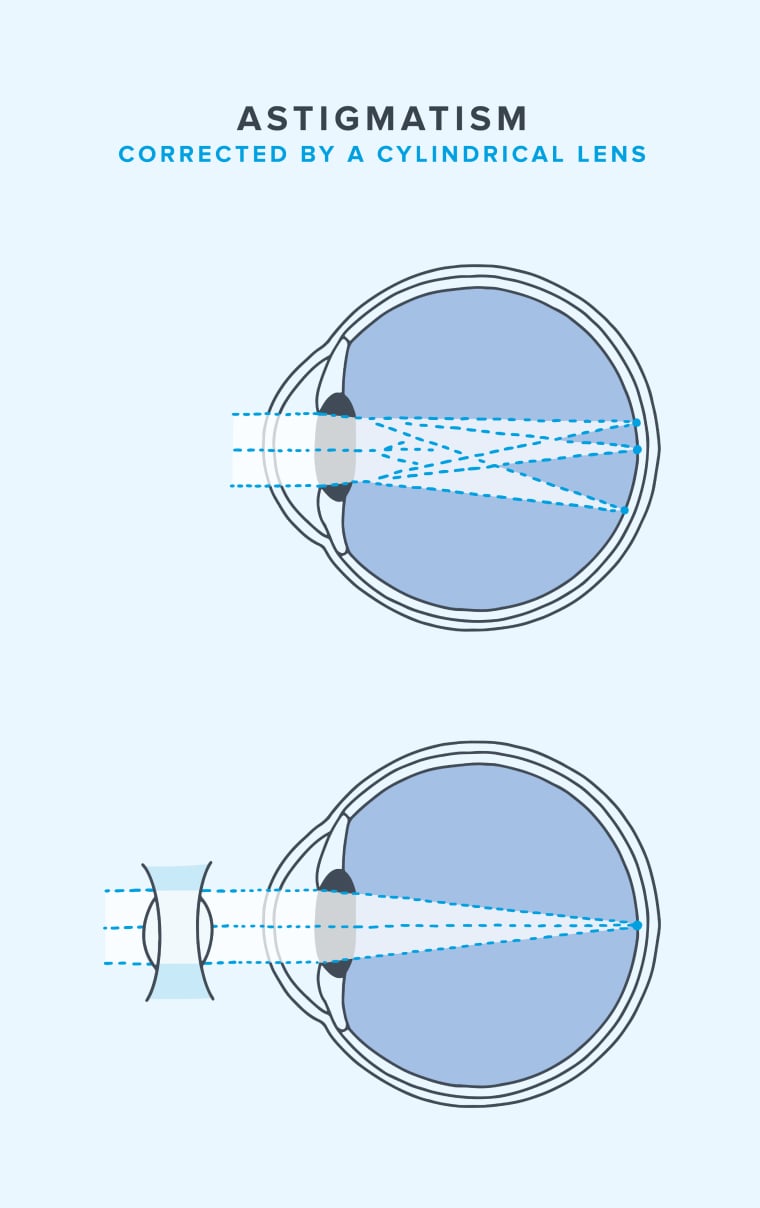 glasses-for-astigmatism-diagram-M.jpg