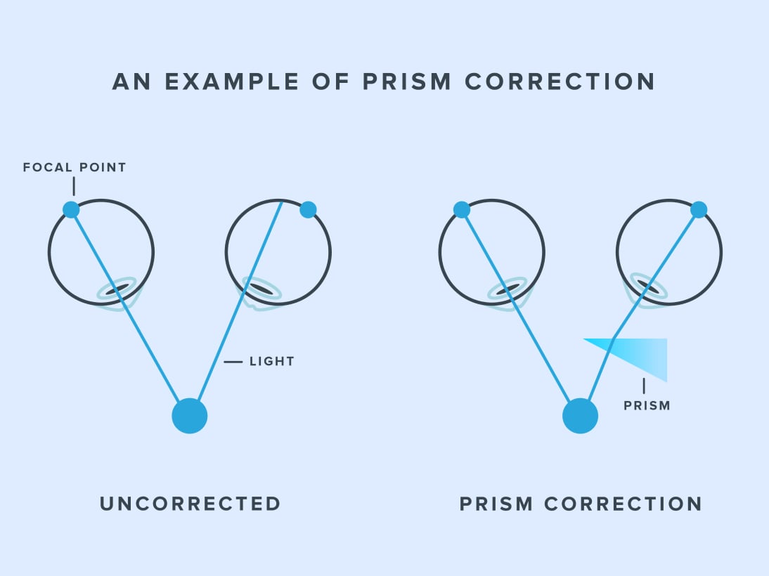 https://www.warbyparker.com/learn/wp-content/uploads/2023/04/prism-correction-illustration.jpg